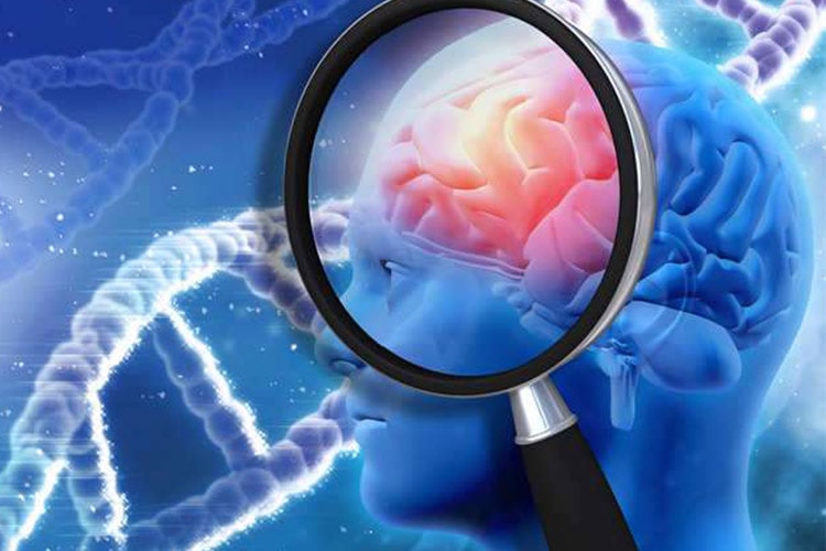 آلزایمر، پارکینسون